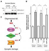 Noncanonical transnitrosylation network contributes to synapse loss in Alzheimer&#039;s disease