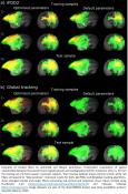 AI to optimize diffusion MRI-based fiber tracking of brain connectome