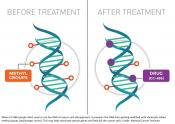 Phase 3 clinical trial reveals life saving drug for acute myeloid leukemia
