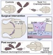 Cranial suture regeneration and neurocognitive defect mitigation by stem cell therapy