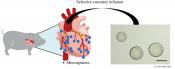 Exosomes from cardiac stem cells to treat dilated cardiomyopathy