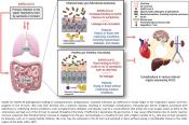 Do an Altered Gut Microbiota and an Associated Leaky Gut Affect COVID-19 Severity?