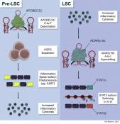 Inflammation transforms pre-leukemia stem cells into leukemia