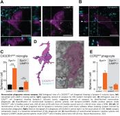 Calcium accumulation activates immune cells to remove synapses in inflammation