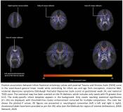 Child&#039;s brain development is associated with fathers exposure to early life stress