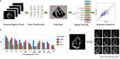 AI can predict death risk