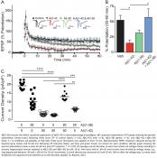 Shorter version Abeta (Abeta-38) protects against Alzheimer&#039;s