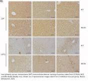Liver alanine catabolism promotes skeletal muscle atrophy and hyperglycaemia in type 2 diabetes
