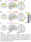Attention recruits frontal cortex in human infants