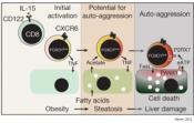 Auto-aggressive immune cells attack liver cells to cause fatty liver