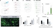Glial enriched stem cell progenitors repair functional deficits due to white matter stroke and vascular dementia 