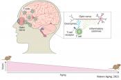 Cytotoxic T cells in aged CNS leads to axon degeneration and cognitive/motor decline