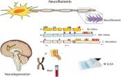 Validation of plasma neurofilament light as biomarker for neurodegeneration