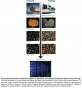 Astronomy meets pathology to identify predictive biomarkers for cancer immunotherapy