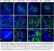 Controlling neuronal hyperactivity in Bourneville&#039;s tuberous sclerosis 