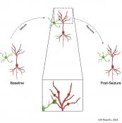 Microglial interaction with injured dendrites in epilepsy 