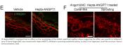 Cellular crosstalk regulates the aqueous humor outflow pathway in glaucoma