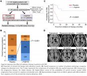 Arginine enhances radiation therapy efficiency in brain tumors
