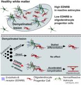 Regulation of remyelination by endothelin receptor &nbsp;