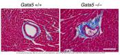 Endothelial Gata5 transcription factor regulates blood pressure