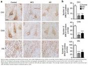 DNA repair factor BRCA1 depletion occurs in Alzheimer brains and impairs cognitive function in mice