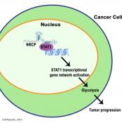 New role for a long noncoding RNA in tumor growth via altered glycolysis