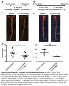 New signaling molecule in atherosclerotic plaque formation