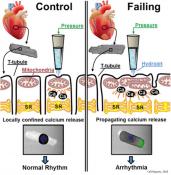 Mechanism of abnormal calcium release in failing heart
