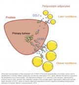 Periprostatic adipocytes act as a driving force for prostate cancer progression in obesity