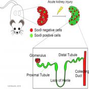 A transcription factor involved in renal tubule epithelial regeneration in mice identified