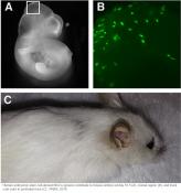 Rodent-human chimeras for disease modeling