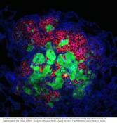 Cancer cells travel together to forge &#039;successful&#039; metastases