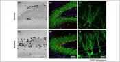 Sustained aerobic exercise increases adult hippocampal neurogenesis