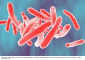 Blood test could transform tuberculosis diagnosis