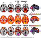 First scans show how the LSD drug affects the brain
