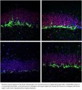 Low-carb diet alleviates inherited form of intellectual disability in mice