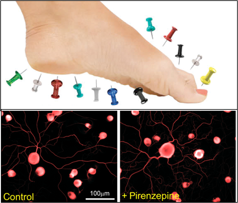 Potential new treatment pathway for peripheral neuropathy