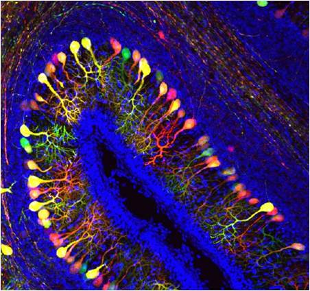 Transporter of thyroid hormones is crucial for the embryonal development of the brain