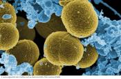 Bacteria-containing skin cream kills pathogen