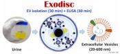 Extracellular vesicle isolation from urine and bladder cancer detection using lab-on-a-disc platform 