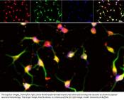 Neural crest cells from adult skin cells without genetic modification!