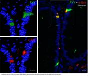 Parkinson&#039;s could start in gut endocrine cells!