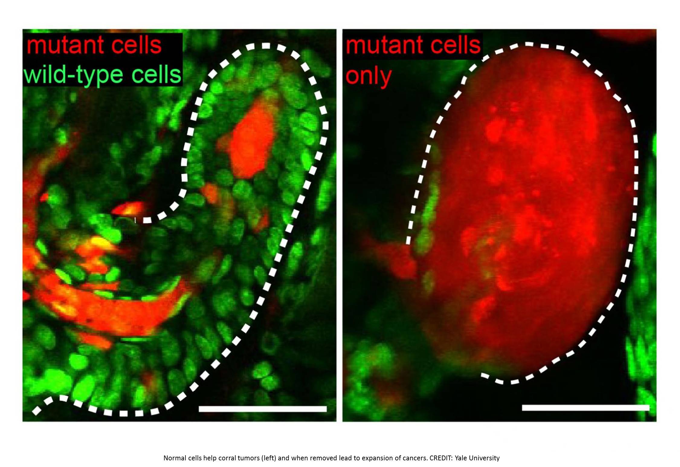 Neighbor cells correct aberrant growth to maintain tissue homeostasis