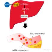 Liver inflammation with long-term diabetes complication raises cholesterol levels