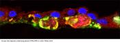 Stem cell models of macular dystrophy