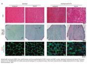 Facioscapulohumeral muscular dystrophy (FSHD) mouse model developed!