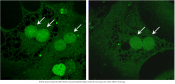 New regulator of liver metabolism discovered