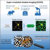 Brain extracellular space imaging using SUSHI