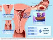 Pap test fluids used in gene-based screening test for two gyn cancers