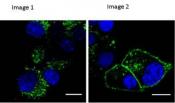 Diabetes compound more effective by altering receptor trafficking